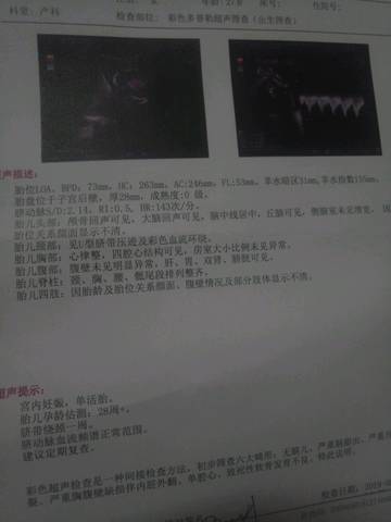 journal_insert_pic_1230601656