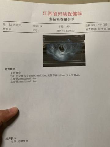 journal_insert_pic_1231016753
