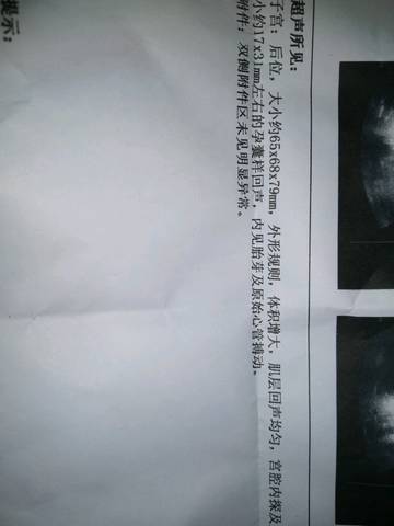 journal_insert_pic_1230905773