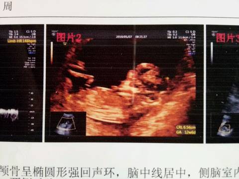 journal_insert_pic_1231276700