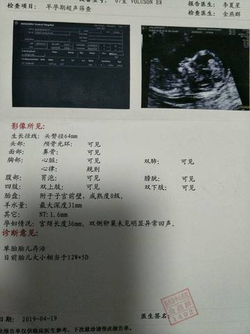 journal_insert_pic_1232045373