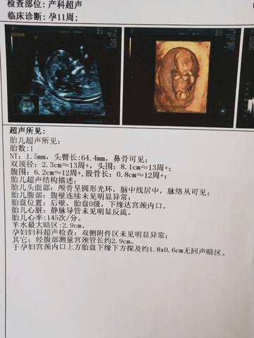 journal_insert_pic_1233826532