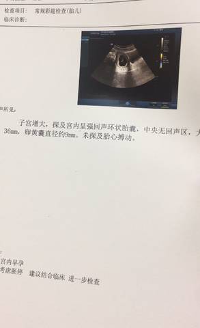 journal_insert_pic_1234873087