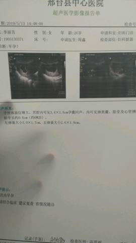 journal_insert_pic_1234930513