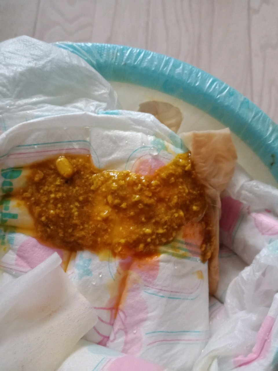 宝宝五个月加10天一直拉这样的宝宝是怎么回事新手妈妈担心