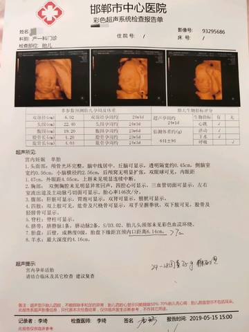 journal_insert_pic_1236432225