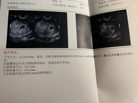 journal_insert_pic_1237786038