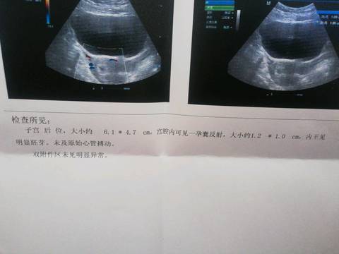 journal_insert_pic_1239045432
