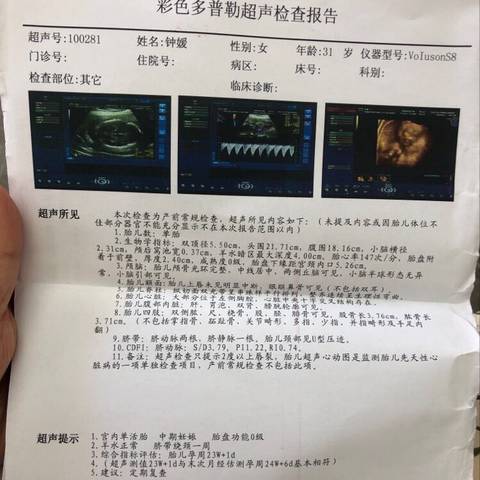 journal_insert_pic_1238913144