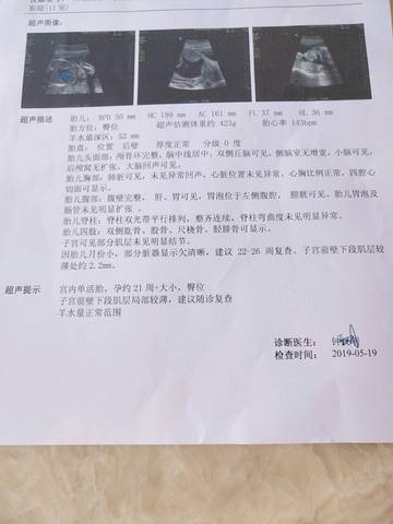 journal_insert_pic_1239010336