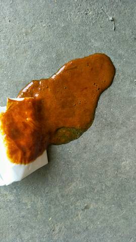 宝宝四个月,大便棕色.什么情况有类似这样的吗?