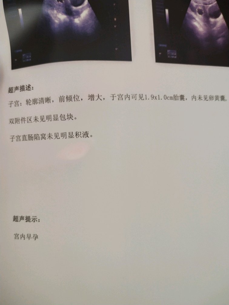 有没有明白的告诉我下