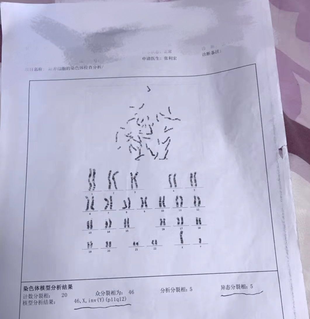 染色体异常的姐妹有吗？