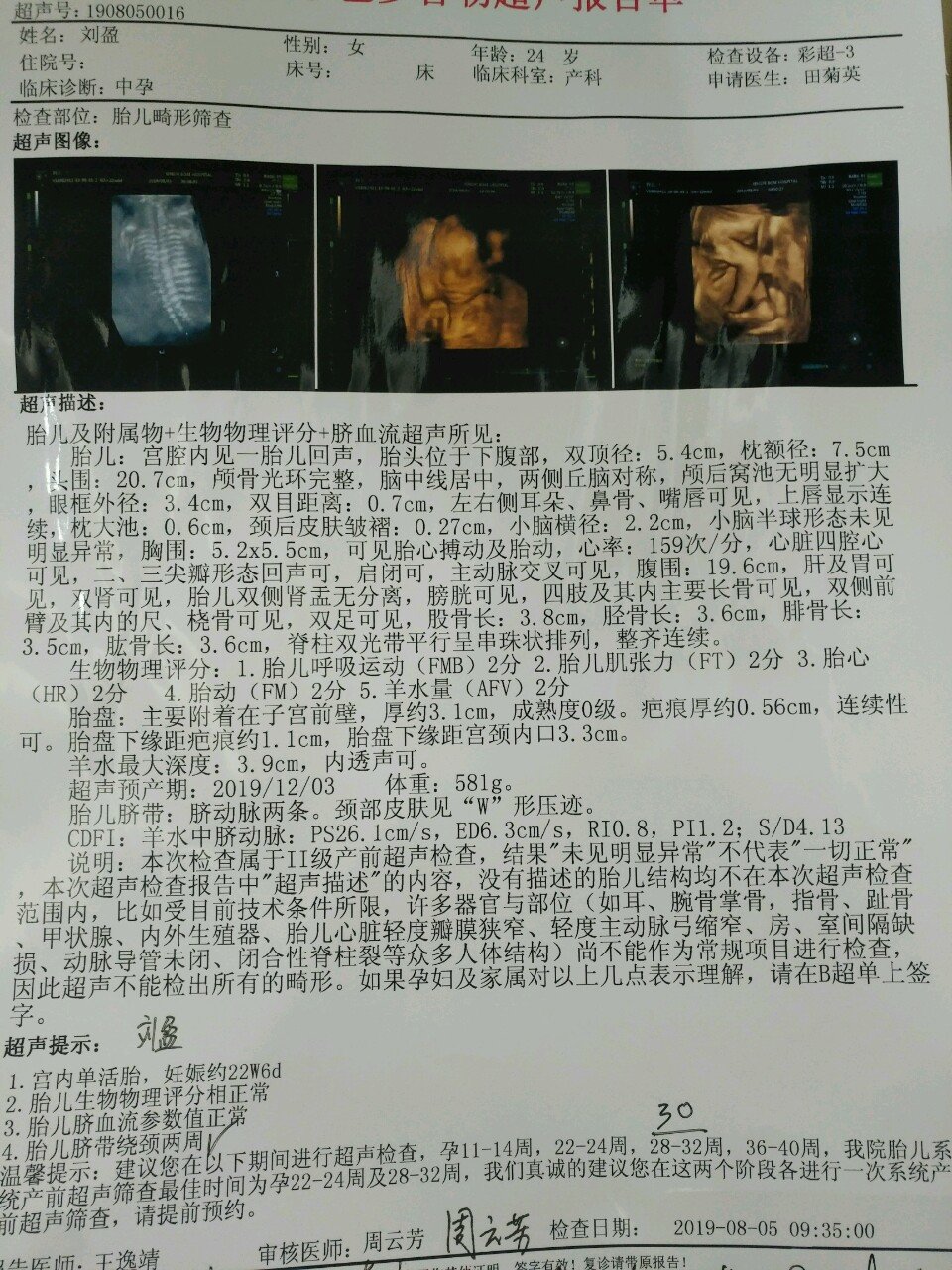 宝妈们，二胎了帮我看看男宝宝还是女宝宝