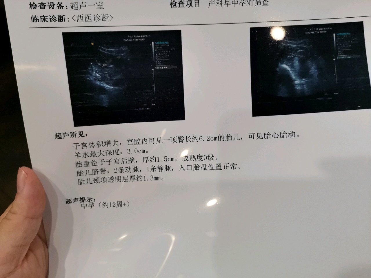 Nt一次过，终于啥事都没有了！