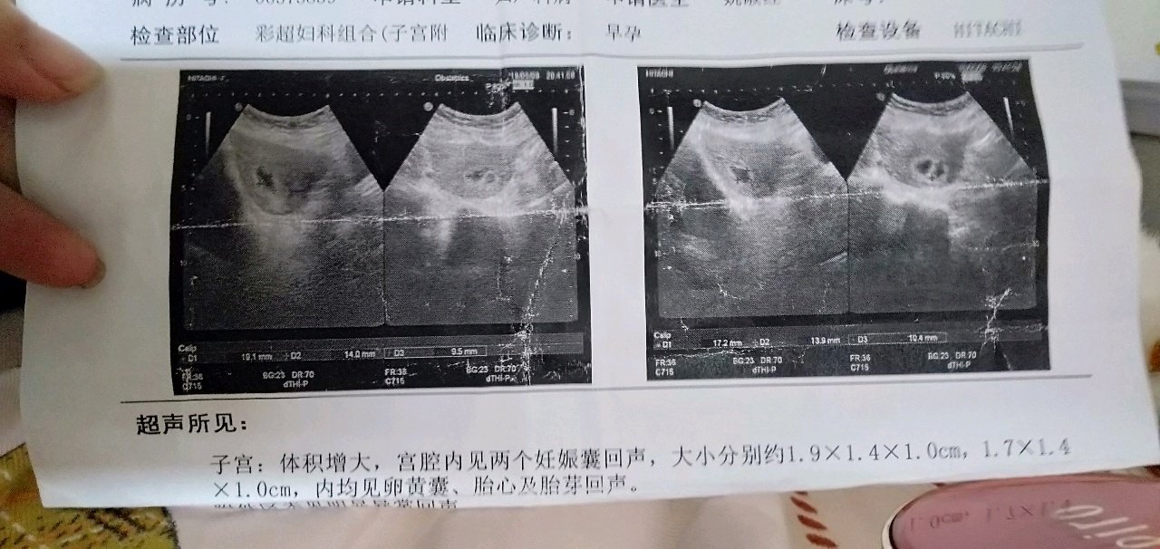 纸都快被我揉烂了