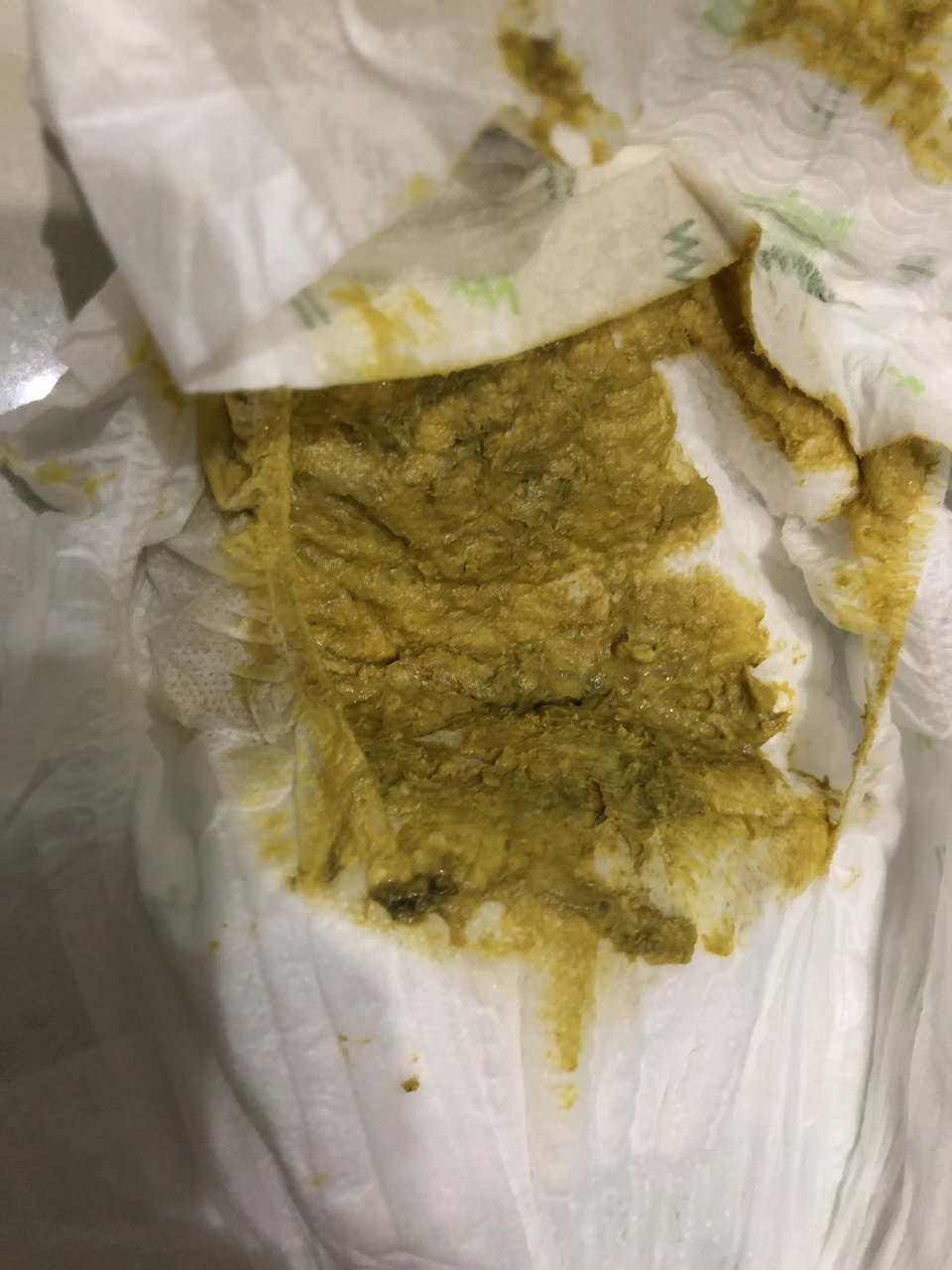 三个月宝宝拉这样的屎正常吗