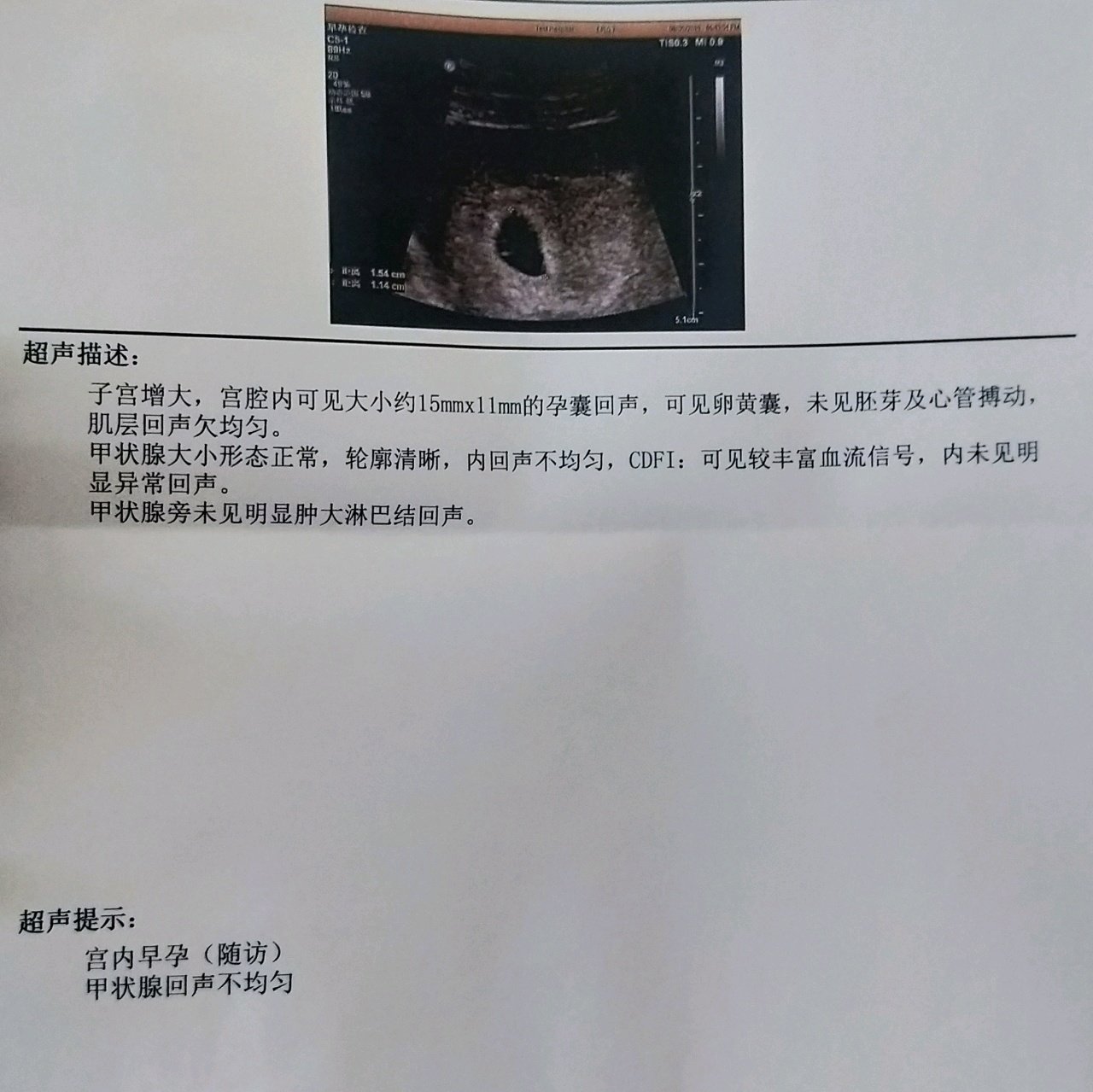 孕50天谁能帮我看看是佩琪还是乔治啊。