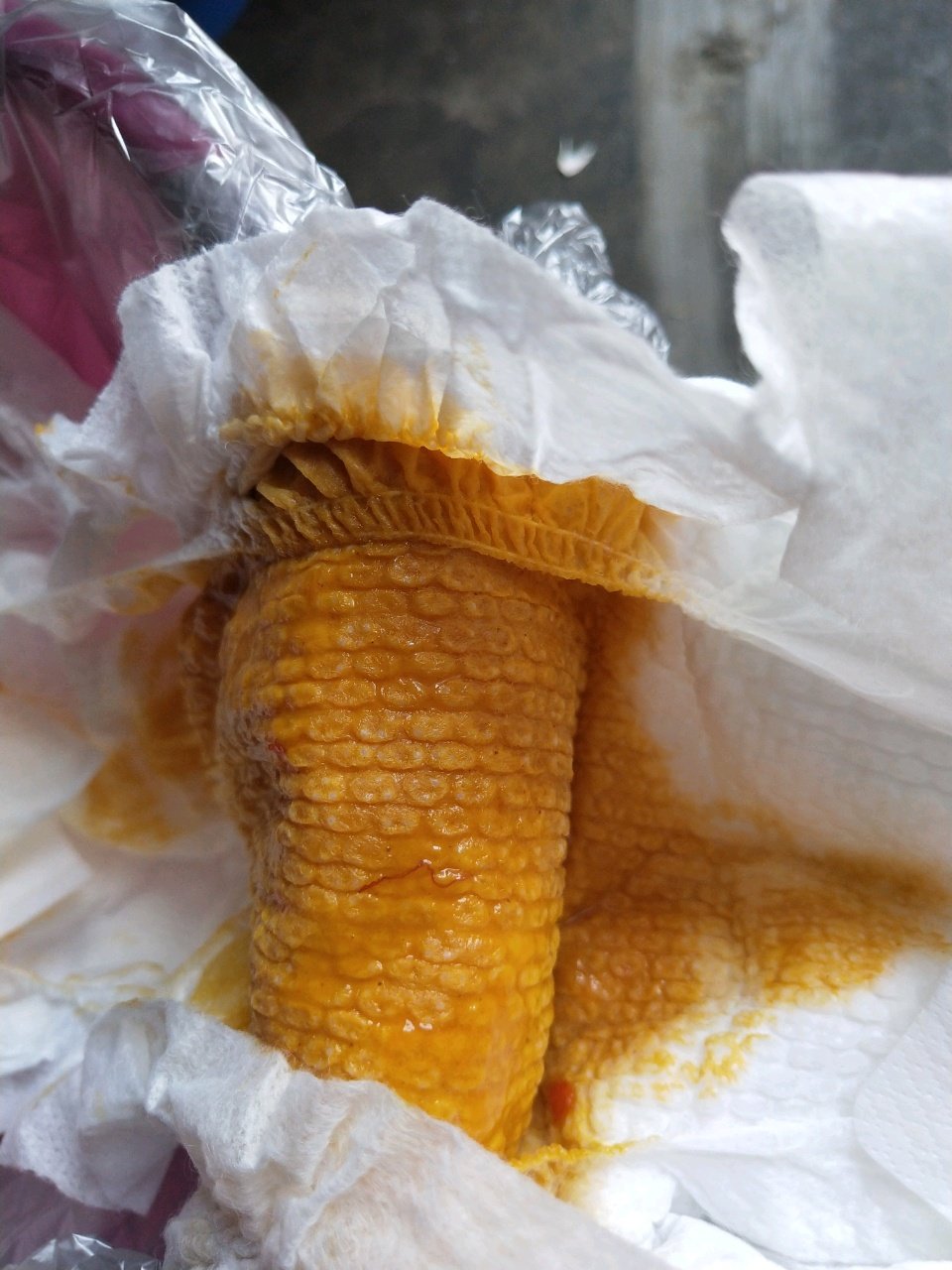 宝宝拉屎里面有红色血丝，这样怎么回事啊，正常吗？