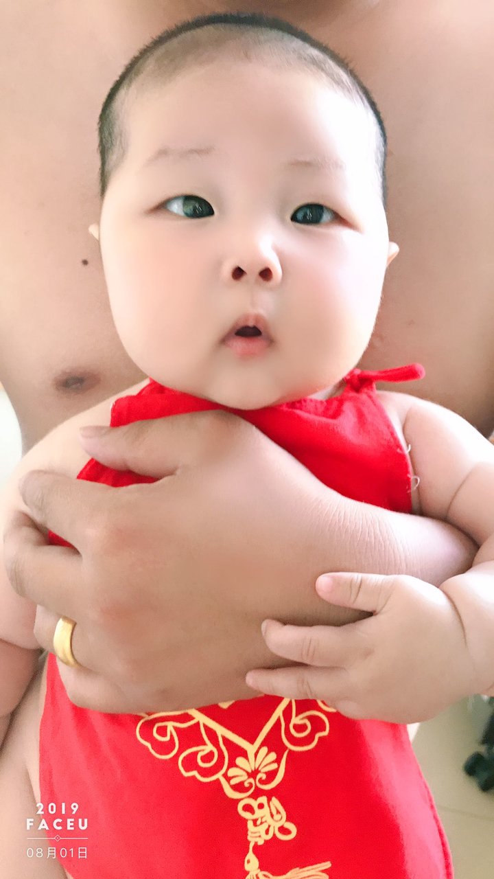 四个半月宝宝  有点对眼  怎么办？？