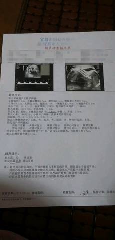 journal_insert_pic_1304296599