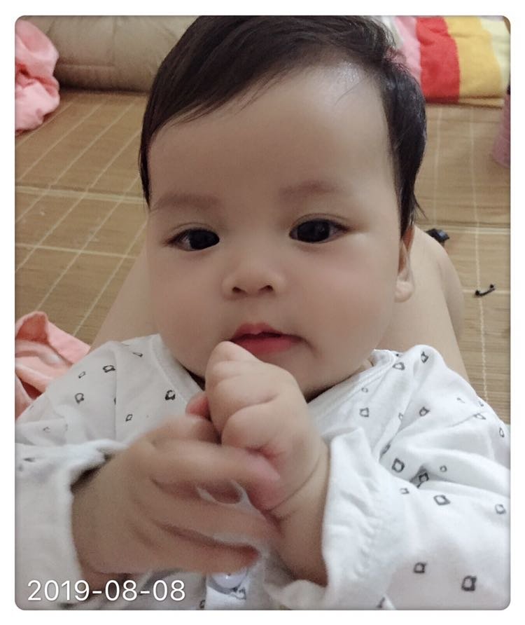 怎么双眼皮说没就没了😔