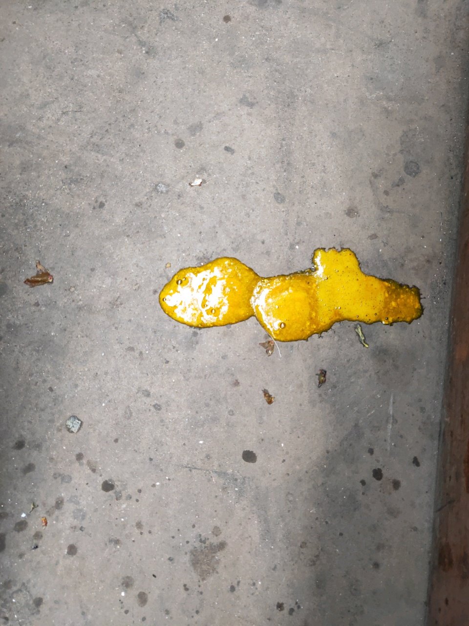 知道的宝妈告诉下我吧，这是拉肚子还是消化不良，（有图慎入）