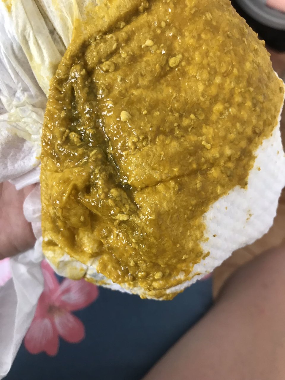 宝宝最近总是拉粑粑里面有白东西 有图慎入