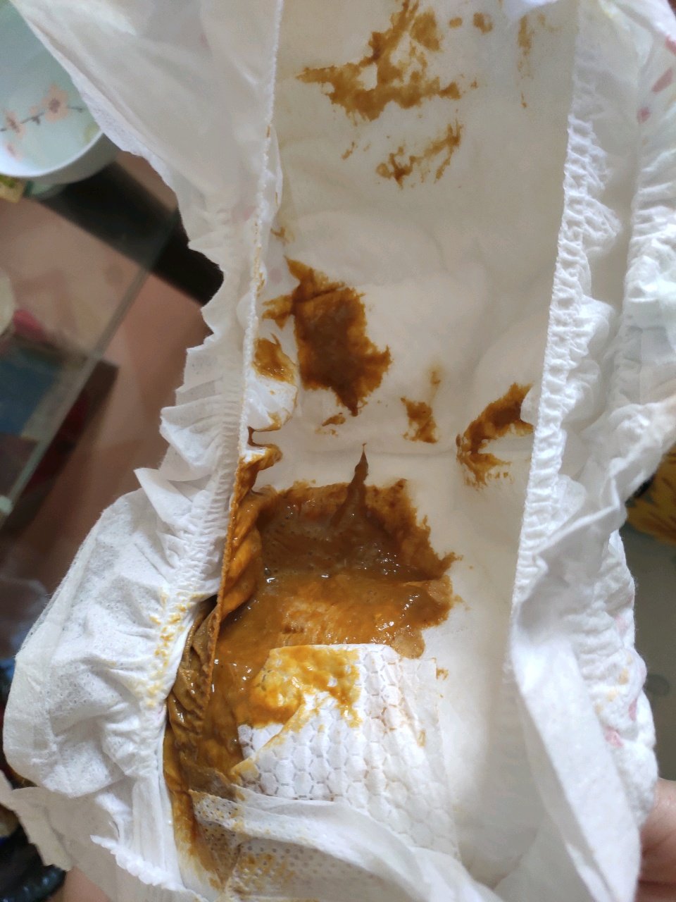 急急急，我儿子拉不出屎怎么办？