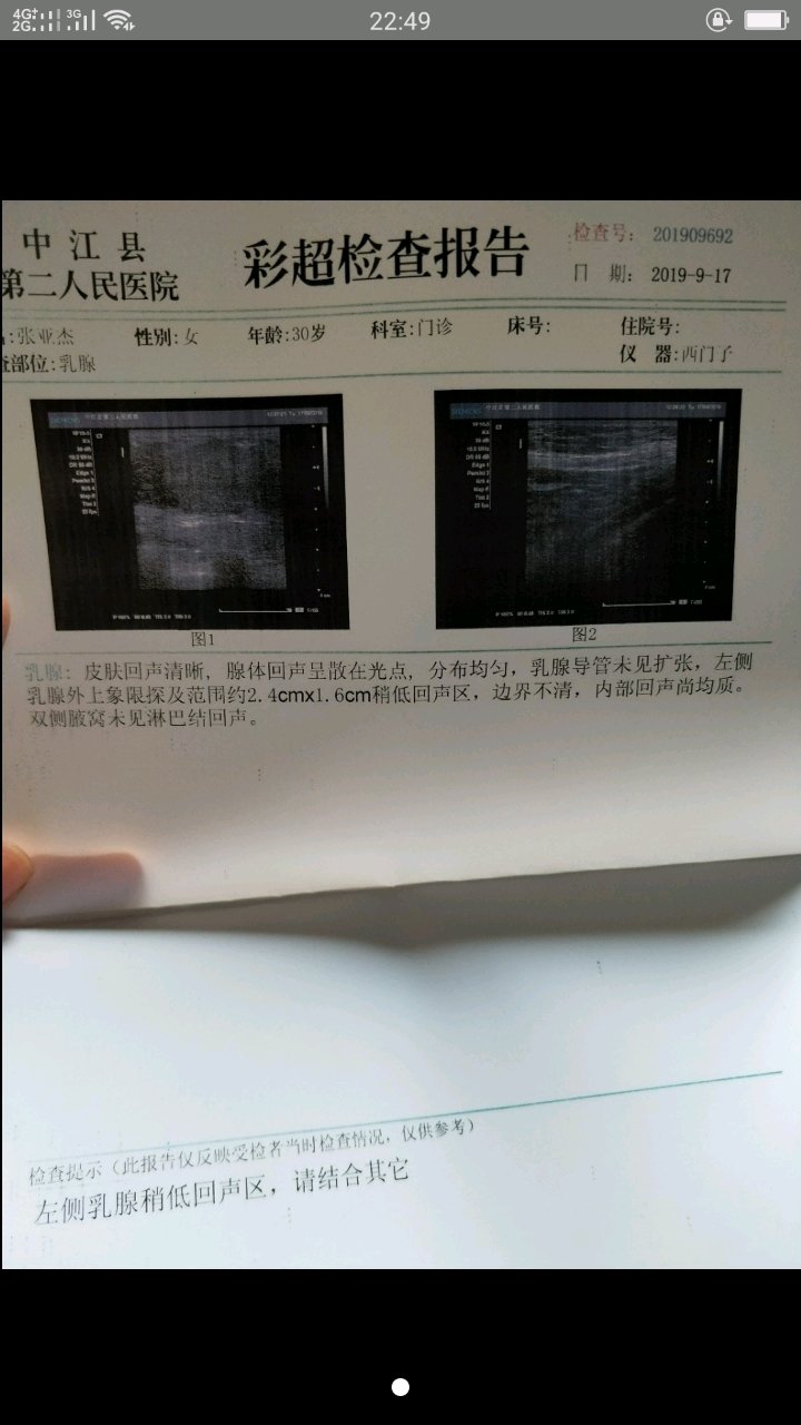 乳房有肿块，却检查不出什么问题，担心……
