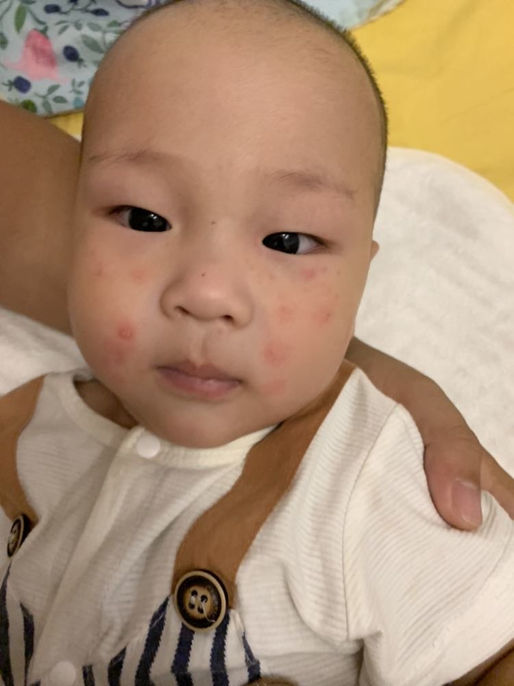 脸上长的是什么呀