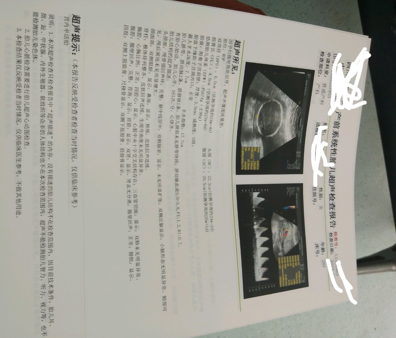 23周系统彩超单出炉