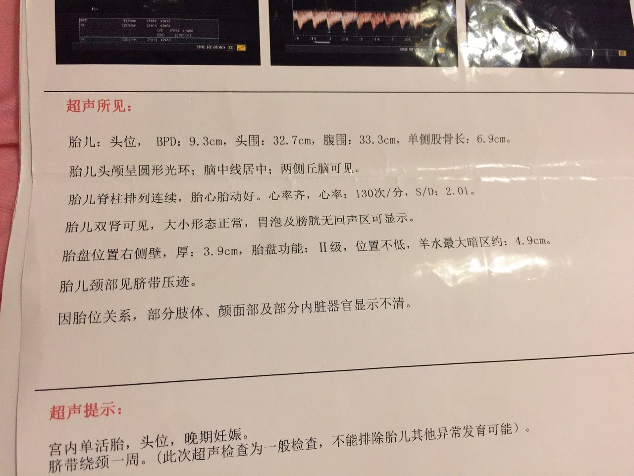 明天就是预产期了还没动静