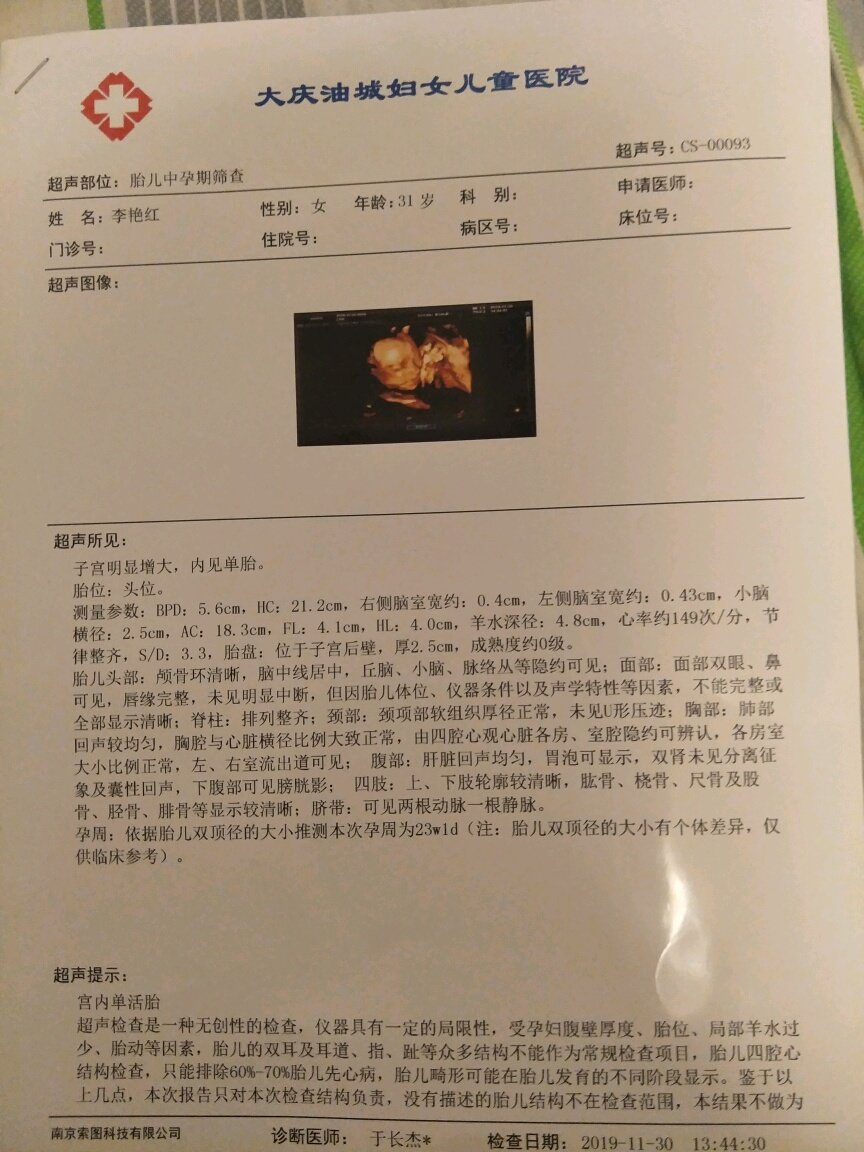 四维，宝妈们，帮忙看看男女，谢谢你