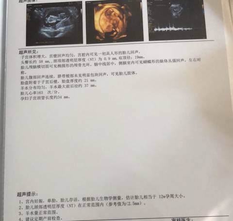 journal_insert_pic_1369774857