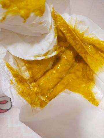 大便有果冻状拉丝粘液,混合喂养,德版白金爱他美和母乳一起混合喂养