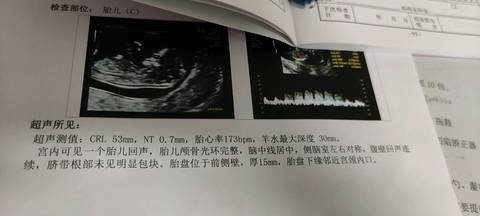 journal_insert_pic_1507276592
