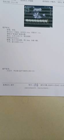 journal_insert_pic_1512110107
