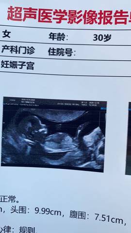 怀孕14周胎儿图 男孩图片