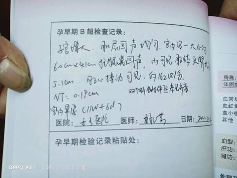 journal_insert_pic_1518831604