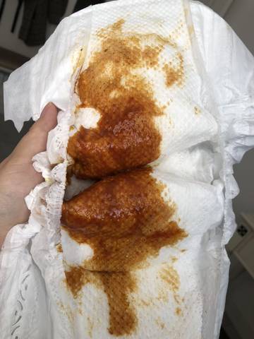 宝宝现在四个月 从两个月开始大便颜色不正常,颜色发红,有黏液 ,次数