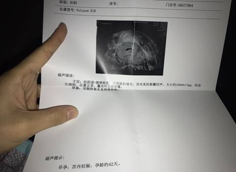 孕囊不规则,孕6周了一直出血腰酸疼,有时肚子也下坠的疼,好担心这是