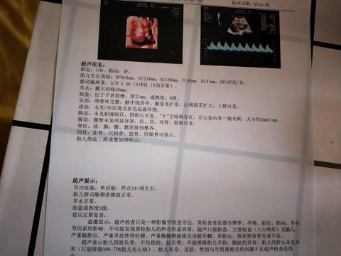 journal_insert_pic_1522522203