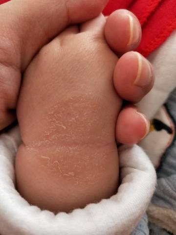 宝宝的手腕是怎么回事?