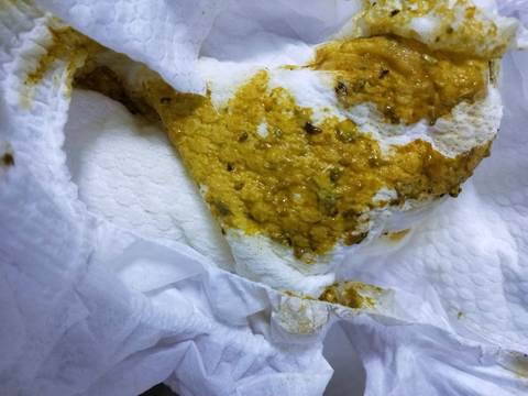 请问大便里面的黑色东西是什么东西?