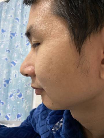 宝宝彩超侧脸和他爹侧脸对比,感觉还是有点像