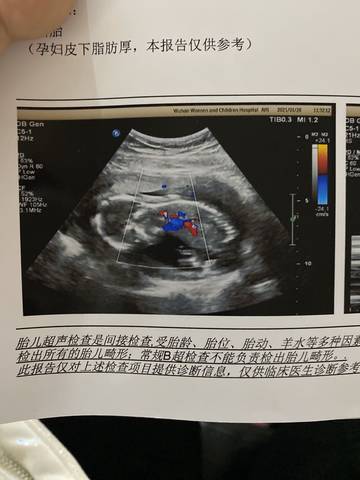 怀孕17周胎儿图片图片