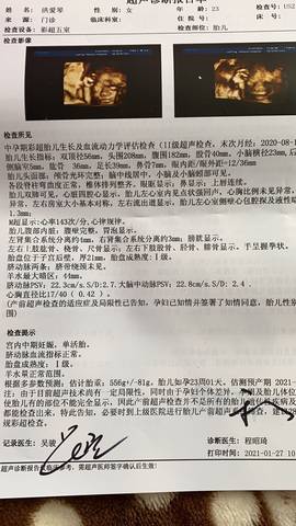 journal_insert_pic_1532235140