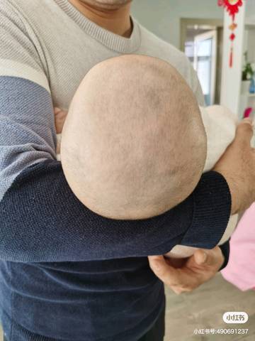 宝宝这个头型该怎么纠正啊