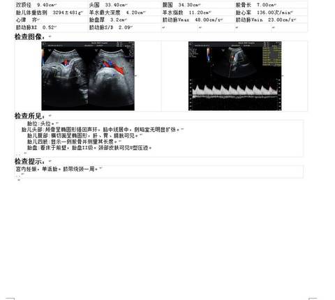 journal_insert_pic_1543686512